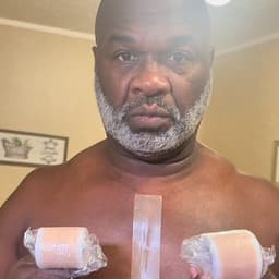 疤痕(心脏)女声