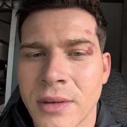 Oliver stark 
