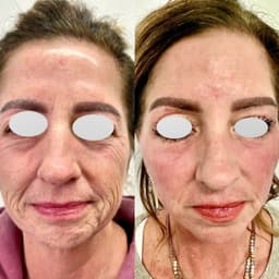 医生对口型12.23