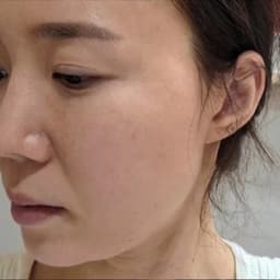 它对付干纹细纹