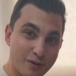 西班牙静脉曲张男医生