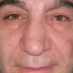 babala