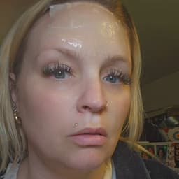 疤痕贴爆款达人