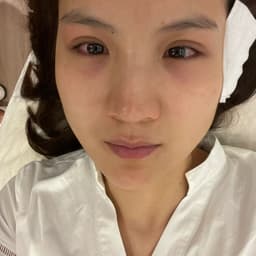 我今年三十八岁，用肽十年