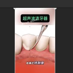 王王王-采访声音