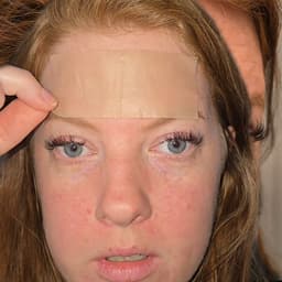 疤痕贴英文达人