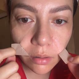 疤痕贴达人英文