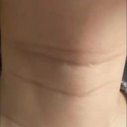 PDRN