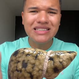 MT-0329-T7-6bajadepesoconmigue